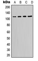 PIK3CD / PI3K Delta Antibody (C-Terminus)