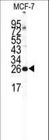 NCS1 / Neuronal Calcium Sensor Antibody (aa118-144)