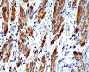 SMMHC / MYH11 Antibody (clone SMM11-1)