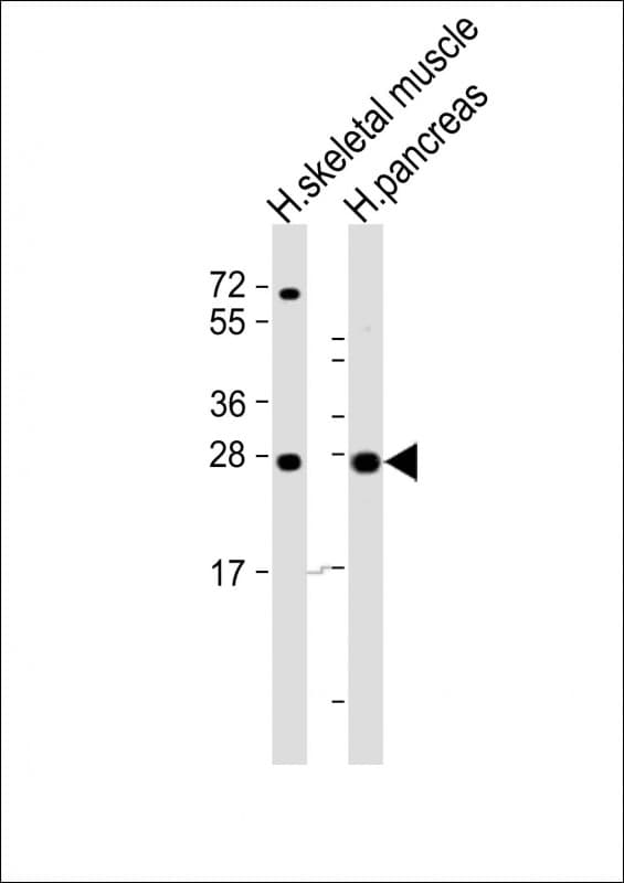 Polyclonal Rabbit anti-Human CELA2B / ELA2B Antibody (aa88-122, WB)