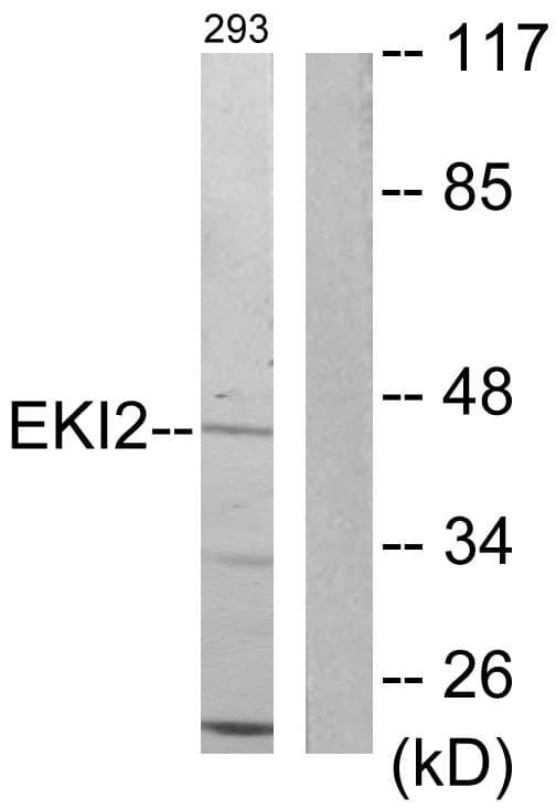 ETNK2 Antibody (aa51-100)