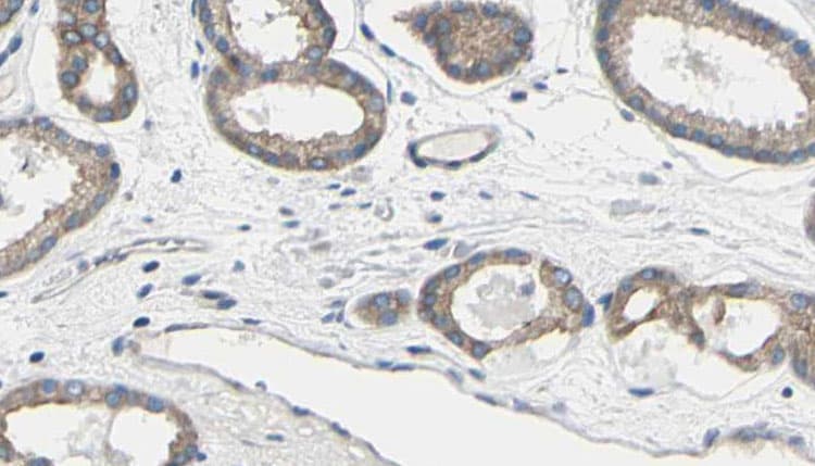 TK1 / TK / Thymidine Kinase Antibody