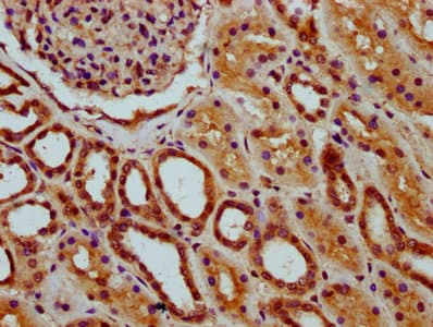 Polyclonal Rabbit anti-Human MEAF6 / C1orf149 Antibody (IHC)