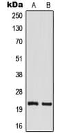 IHC-plus™ TM2D1 / BBP Antibody (Internal)