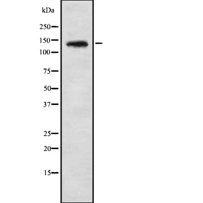 PHKA1 + PHKA2 Antibody