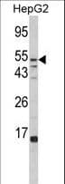 IHC-plus™ Polyclonal Rabbit anti-Human Alpha Fucosidase / FUCA1 Antibody (aa265-294, IHC, WB)