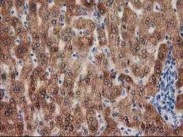 GRHPR / Glyoxylate Reductase Antibody (clone OTI1A9, Carrier-free)