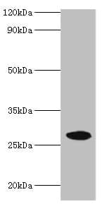 NMNAT3 Antibody (aa1-215)