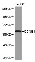 Polyclonal Rabbit anti-Human CCNB1 / Cyclin B1 Antibody (IHC, WB)
