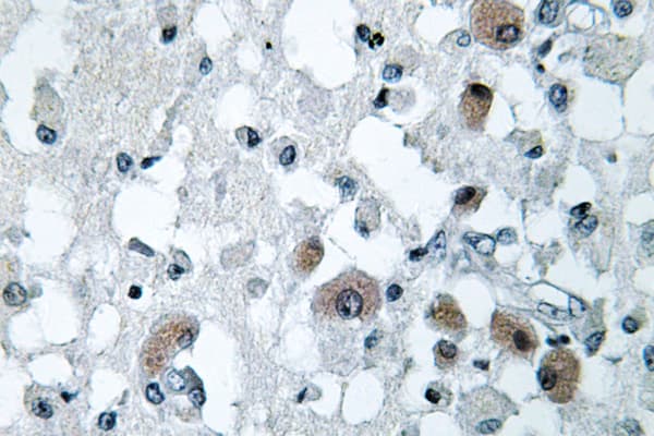 Polyclonal Rabbit anti-Human KDELR3 Antibody (Leu95, IHC, WB)