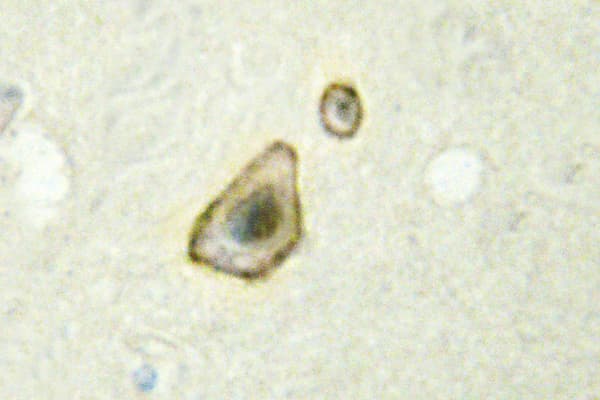 Polyclonal Rabbit anti-Human CYP19 / Aromatase Antibody (Lys243, IHC, IF, WB)