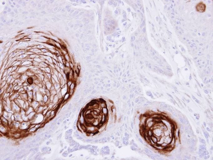 CEACAM5 / CD66e Antibody (aa395-702)