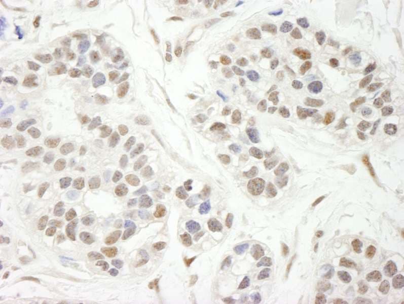 Polyclonal Rabbit anti-Human ZBTB7A / Pokemon Antibody (aa525-C-term, IHC)