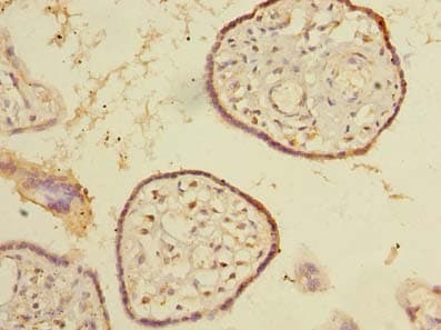SNX16 Antibody
