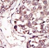 Polyclonal Rabbit anti-Human RYK Antibody (aa561-591, IHC, WB)