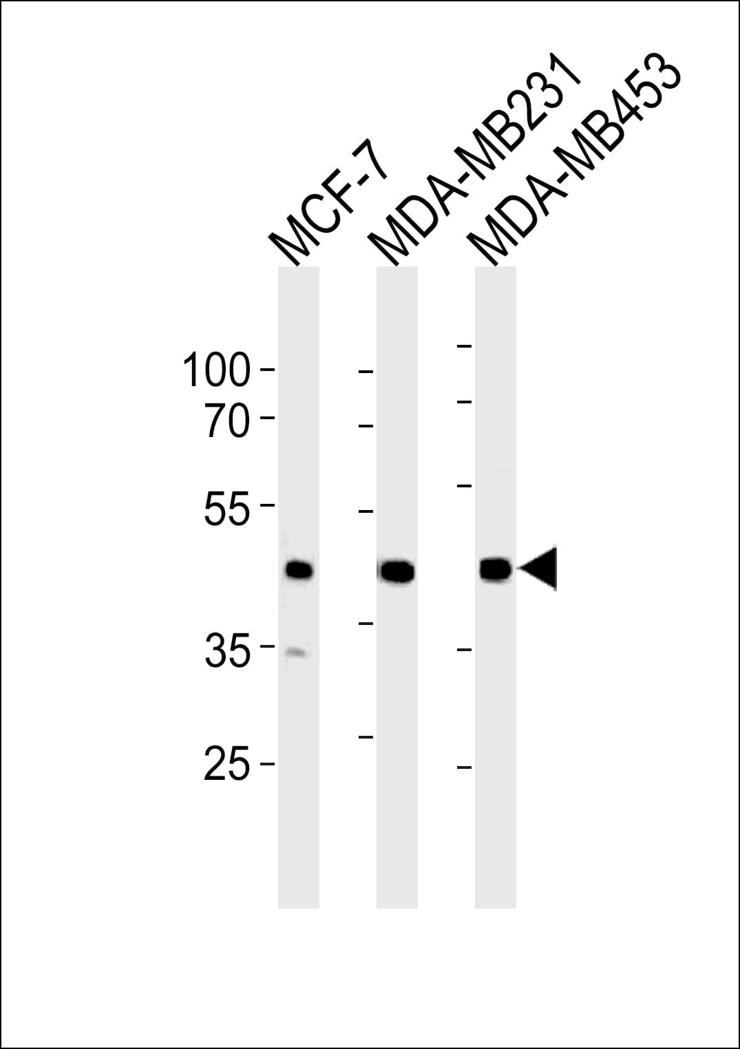 SGCG / Gamma-Sarcoglycan Antibody (aa145-172)