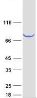 Human SCEL Protein (Recombinant Myc-DDK (Flag))