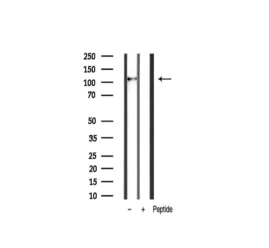 Polyclonal Rabbit anti-Human CDH1 / E Cadherin Antibody (IHC, IF, WB)