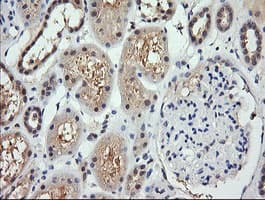 RARRES1 Antibody (clone OTI1D2, Carrier-free)