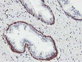 APMAP / C20orf3 Antibody (clone OTI3F2)
