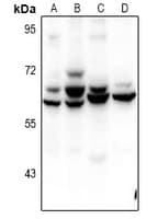 ZNF498 Antibody