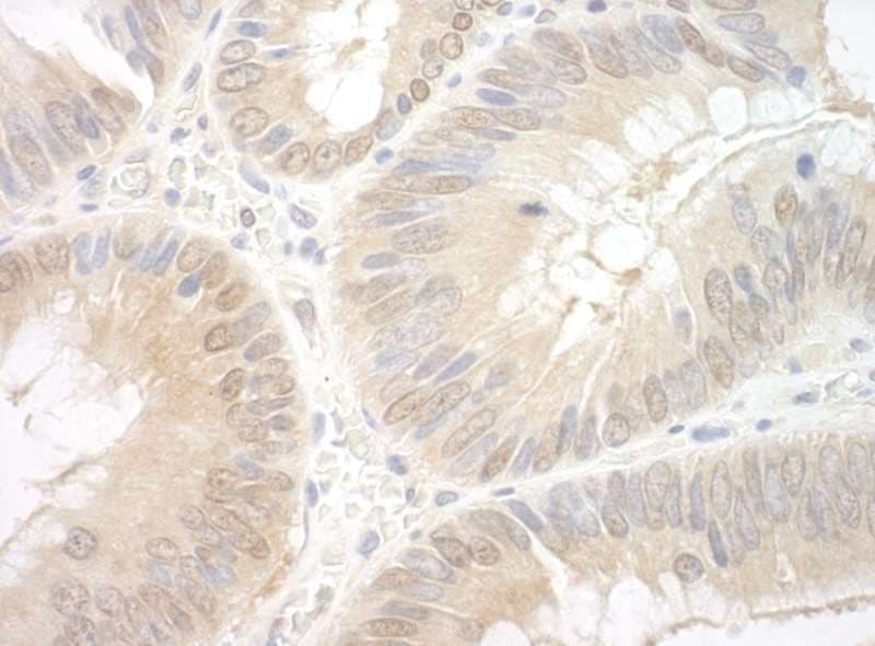 EAF2 / U19 Antibody (aa150-200)