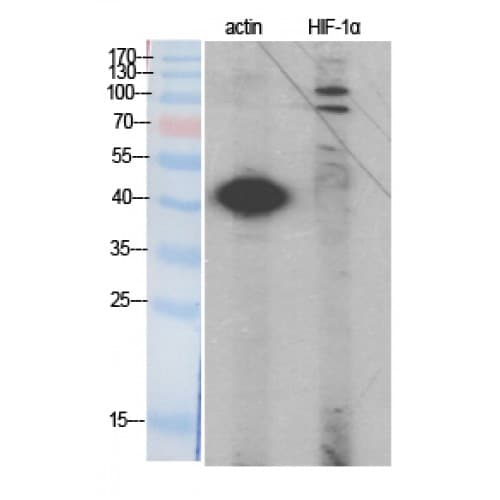 Polyclonal Rabbit anti-Human HIF1A / HIF1 Alpha Antibody (Internal, IHC, WB)