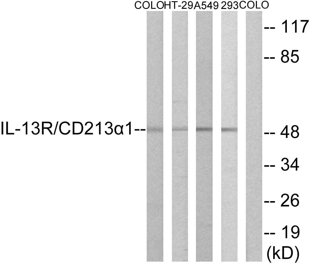 IL13RA1 / IL13R Alpha 1 Antibody (p405)