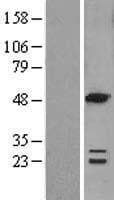 ACOT6 Protein (Over-Expression Lysate Myc-DDK (Flag))
