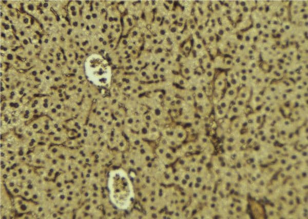 Polyclonal Rabbit anti-Human SH3BGRL3 Antibody (IHC, WB)