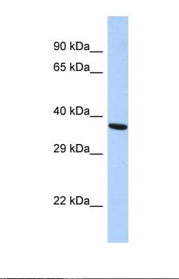 Polyclonal Rabbit anti-Human BDNF Antibody (aa150-199, WB)