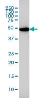 GSR / Glutathione Reductase Antibody (clone 6B4)