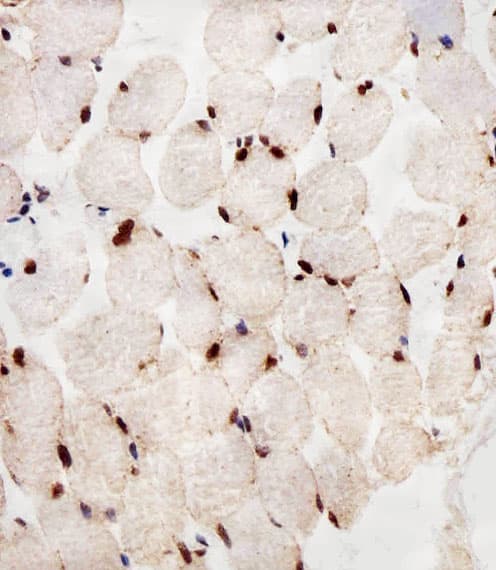 Monoclonal Mouse anti-Human PPARA / PPAR Alpha Antibody (clone 1331CT894.186.143, IHC, IF, WB)