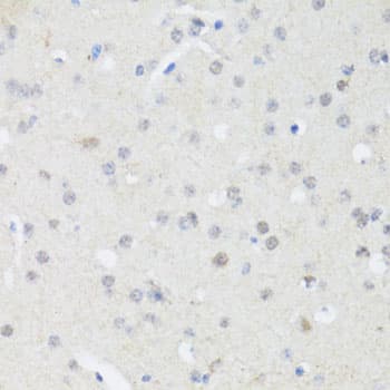 Polyclonal Rabbit anti-Human EP300 / p300 Antibody (IHC, WB)