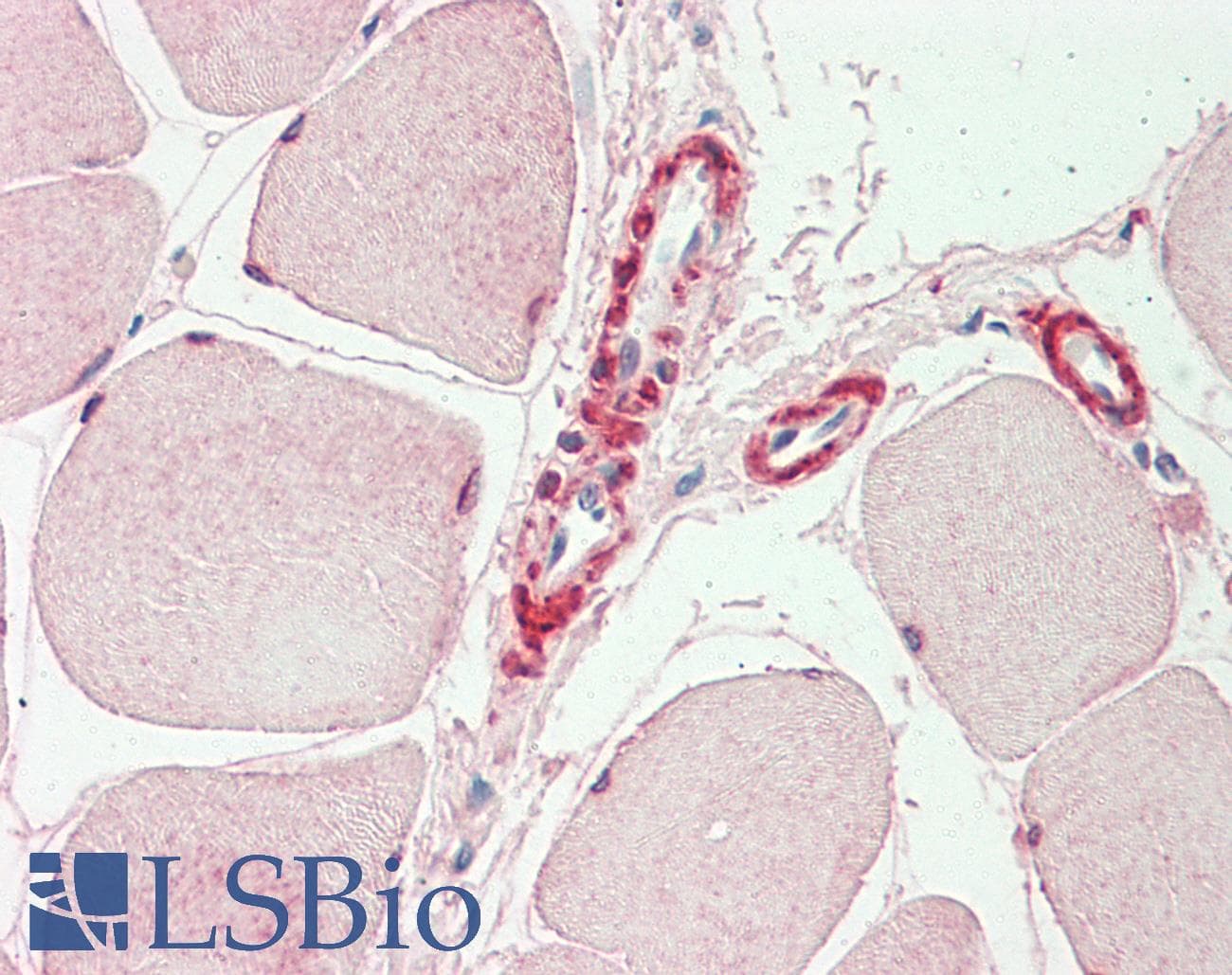 IHC-plus™ INPP5K / SKIP Antibody (aa183-430)