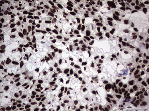 HNRNPL / hnRNP L Antibody (aa270-502, clone OTI9F11)