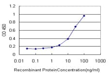 IHC-plus™ Monoclonal Mouse anti-Human CTBP1 / CTBP Antibody (clone 2G7, IHC, IF, WB)