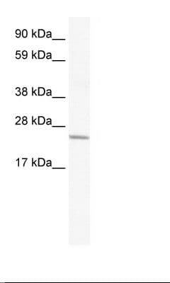 CRIP2 Antibody (aa78-127)