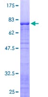 Human RPL3 / Ribosomal Protein L3 (Recombinant GST)