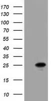 AK3 / Adenylate Kinase 3 Antibody (clone OTI5A1)