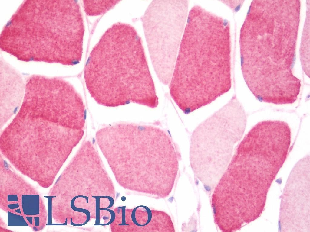 IHC-plus™ Polyclonal Rabbit anti-Human EMCN / Endomucin Antibody (aa4-206, IHC, WB)