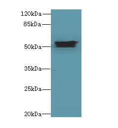 ALDH1A1 / ALDH1 Antibody