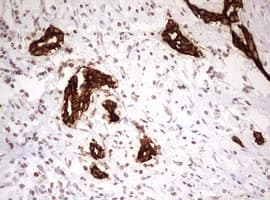 KRT7 / CK7 / Cytokeratin 7 Antibody (clone OTI1C5)