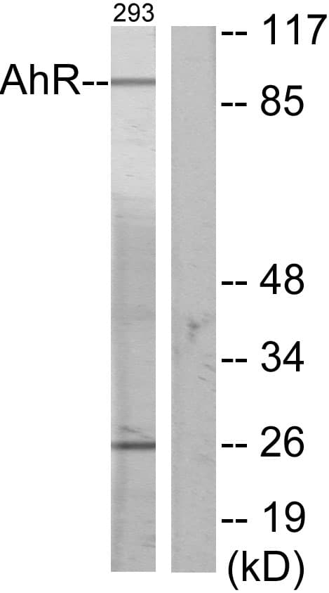 IHC-plus™ Polyclonal Rabbit anti-Human AHR Antibody (aa2-51, IHC, IF, WB)