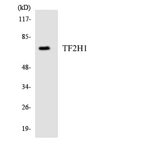 IHC-plus™ Polyclonal Rabbit anti-Human TFB1 / GTF2H1 Antibody (aa32-81, IHC, WB)