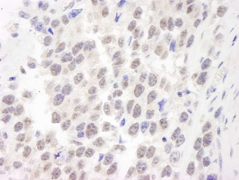 WRN Antibody (aa1400-C-term)