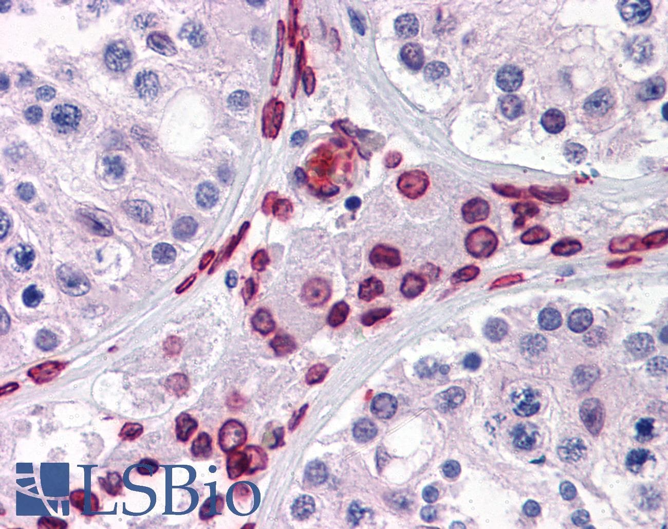 IHC-plus™ WDR20 Antibody (clone 2A6)