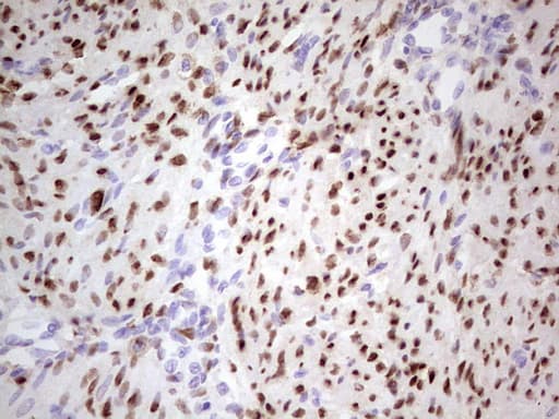 PR / Progesterone Receptor Antibody (aa1-298, clone OTI24D6)