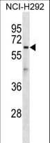 Polyclonal Rabbit anti-Human ATL1 Antibody (aa477-504, WB)