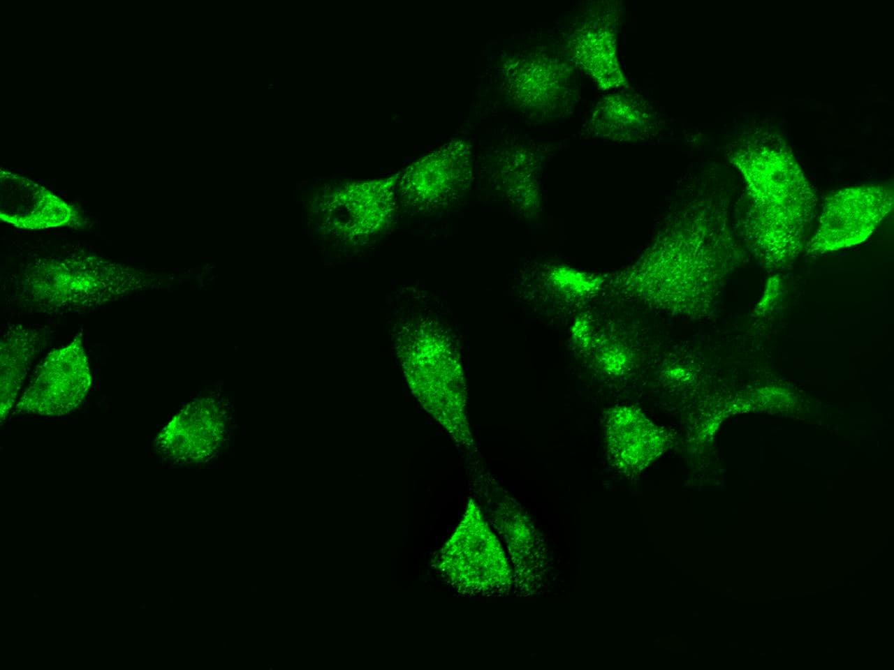 LGALS7 / Galectin 7 Antibody (Preservative Free)
